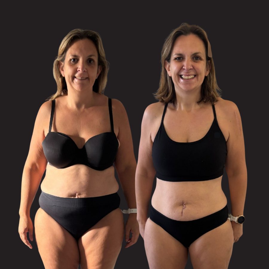 LFG member before and after: slimmer waist and hips